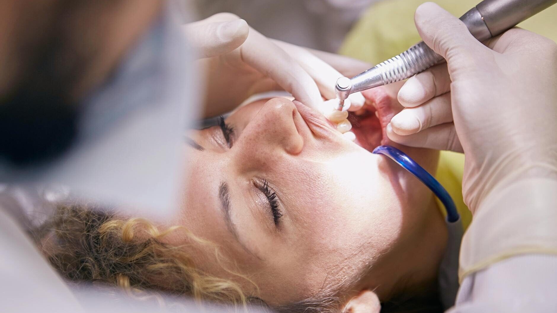 Kvinde i tandlægestol- Genrefoto: Andrea Piacquadio, Pexels.com